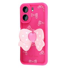 Xiaomi Redmi 13C Kılıf Kamera Korumalı Figür Tasarımlı Glam Kapak Pembe - Pembe